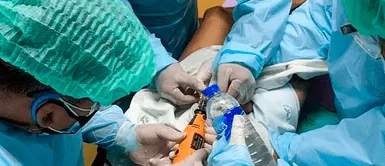 Salman Mirza usó pegamento en el pene Salman Mirza: El joven que murió por sellar su pene con pegamento como anticonceptivo