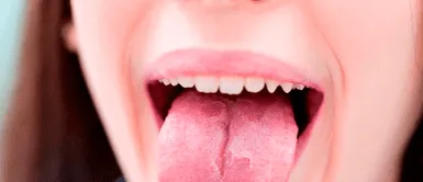 Por qué me muerdo la lengua cuando como ¿Por qué me muerdo la lengua o las zonas dentro de la boca cuando mastico?