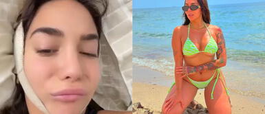 Famosa modelo se somete a cirugías estéticas tras críticas a su cuerpo y termina con parálisis Famosa modelo se somete a cirugías estéticas tras críticas a su cuerpo y termina con parálisis