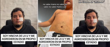 Barrista de la 'U' desfigura rostro a hincha 'crema' tras acusarlo de infiltrado: "Me agredieron en mi propio estadio" Barrista de la 'U' desfigura rostro a hincha 'crema' tras acusarlo de infiltrado: "Me agredieron en mi propio estadio"