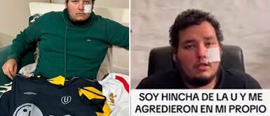 Hincha de Universitario de Deportes fue agredido en el Monumental de Ate Hincha de Universitario fue desfigurado en el Monumental y denunciaría al equipo de sus amores: "Me sentí solo"