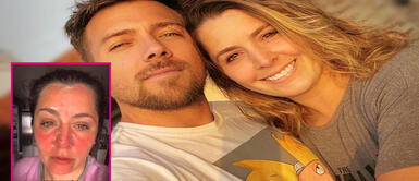 Yiddá Eslava narró el terrible momento que paso en el Cusco Yiddá Eslava sufre gravísimas quemaduras en el rostro y sus seguidores estallan de preocupación: ¿Qué le ocurrió?