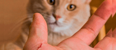 Rabia humana: ¿Es posible contagiarme por la mordedura o arañazo de un gato? Rabia humana: ¿Es posible contagiarme por la mordedura o arañazo de un gato?