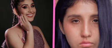 Milena Warthon conmueve al revelar desafiante batalla contra enfermedad. Milena Warthon revela que padece esta DESAFIANTE enfermedad y preocupa a todos: “Prometo no rendirme”