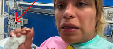 Paola Suárez, amiga de Wendy Guevara, está hospitalizada; novio la golpeó brutalmente Paola Suárez, amiga de Wendy Guevara, está hospitalizada; novio la golpeó brutalmente