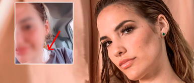 Cassandra Sánchez se somete a delicada cirugía: apareció con un parche en el cuello Cassandra Sánchez se somete a delicada cirugía: apareció con un parche en el cuello