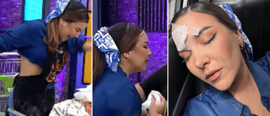 Ale Fuller reveló inéditas fotografías tras sufrir accidente en 'El Gran Chef Famosos'. Ale Fuller expone inéditas fotografías tras sufrir accidente en 'El Gran Chef' que afectó su rostro