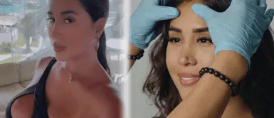 Melissa Paredes se somete a transformación radical tras su ruptura con Anthony Aranda Melissa Paredes se somete a CAMBIO RADICAL con procedimiento estético tras su ruptura con Anthony Aranda