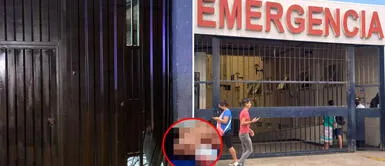 Trujillo: delincuente extranjero pierde la mano tras intentar asaltar una vivienda con una carga de dinamita Trujillo: delincuente extranjero pierde la mano tras intentar asaltar una vivienda con una carga de dinamita