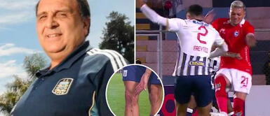 Asesor FIFA indicó que árbitro Diego Ureta perjudicó a Alianza Lima por no expulsar a Carlos Garcés Asesor FIFA indicó que árbitro Diego Ureta perjudicó a Alianza Lima por no expulsar a Carlos Garcés