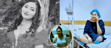 Madre de la 'Muñequita Milly' cuenta los días de dolor que vivió su hija Revelan VIDEO inédito de la ‘Muñequita Milly’ mientras agonizaba de dolor tras la operación