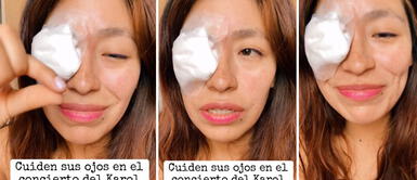 Peruana al borde de las lágrimas cuenta que casi pierde el ojo en concierto en Karol G y nadie la ayudó Peruana al borde de las LÁGRIMAS cuenta que casi PIERDE EL OJO en concierto en Karol G y nadie la ayudó