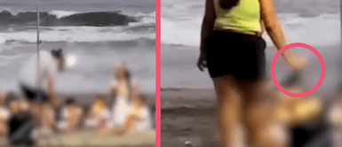 Dos niños sufren fuertes quemaduras de segundo y tercer grado durante sesión fotográfica en Lurín: “Le arruinaron la vida” Dos niños sufren fuertes quemaduras de segundo y tercer grado durante sesión fotográfica en Lurín: “Le arruinaron la vida”