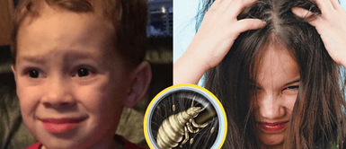 Mujer se vuelve viral por no querer quitarle los piojos a su hija por increíble razón Madre vegana SE NIEGA a QUITARLE los PIOJOS a su hija por INSÓLITA razón: "Son seres que sienten"