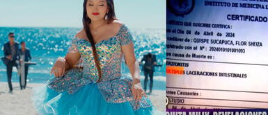 Dónde está el intestino de la Muñequita Milly: abogado denuncia desaparición de 15 centímetros Dónde está el intestino de la Muñequita Milly: abogado denuncia desaparición de 15 centímetros