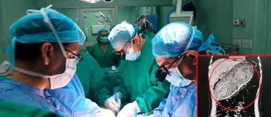 Adolescente acude por dolor de estómago a hospital de Juliaca y médicos le extraen una bola de pelos de casi 4 kilos Adolescente acude por dolor de estómago a hospital de Juliaca y médicos le extraen una bola de pelos de casi 4 kilos