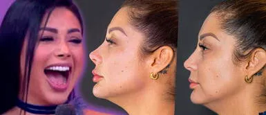 Karla Tarazona se hace retoquitos en la cara y aseguran que se quiere parecer a Pamela Franco Karla Tarazona se hace retoquitos en la cara y aseguran que se quiere parecer a Pamela Franco