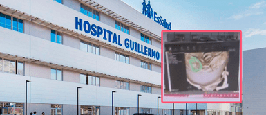 VMT: Niño de seis años va al dentista y termina con una aguja en la cabeza VMT: Niño de seis años va al dentista y termina con una aguja en la cabeza