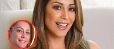 Karla Tarazona sorprende con nuevos retoques estéticos para lucir siempr Karla Tarazona sorprende con nuevo rostro al realizarse retoques estéticos para lucir joven