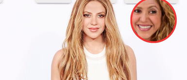 Shakira apareció en redes sociales con nuevo rostro que preocupó a sus fans Shakira apareció en redes sociales con nuevo rostro que preocupó a sus fans