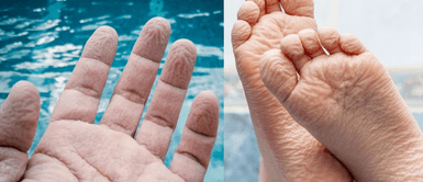 ¿Por qué se arruga la piel en el agua? Conoce por qué se arrugan los dedos en el agua