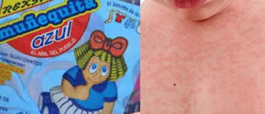 Muñequita Azul puede ser un producto tentador para tratar el sarpullido en bebés, es importante considerar los riesgos asociados a su uso. ¿Por qué no debes usar 'Muñequita Azul' para tratar el sarpullido en bebés?