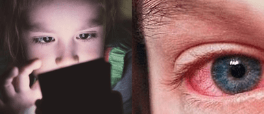 El uso prolongado de los dispositivos móviles causa daño a largo plazo. ¡No te quedes viendo memes hasta tarde! Conoce cómo el uso del celular daña tu visión