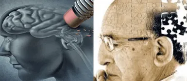 ¿Cómo prevenir la demencia? ¡Protege tu mente! Estrategias clave para prevenir la demencia ahora