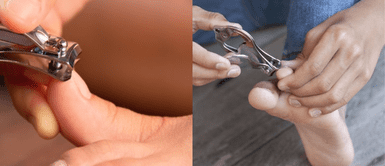 El mal hábito de cortar tus uñas de los pies podría llevarte al quirófano por complicaciones inesperadas. El error que cometemos al cortar las uñas de los pies y que podría llevarte al quirófano