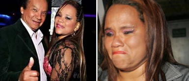 La hija del comediante sufre fuerte accidente. Yessenia Villanueva, hija de Melcochita, sufre grave accidente: "Me rompí la cabeza"