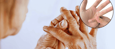 No te saques más 'conejos'. Sacarse ‘conejos’ de los dedos es malo, según expertos