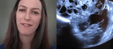 Doctora diagnosticada de cáncer de colon en etapa 4, reveló cuáles son los síntomas específicos a tener en cuenta Doctora diagnosticada de cáncer de colon en etapa 4, reveló cuáles son los síntomas específicos a tener en cuenta