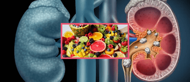 Conoce la fruta milagrosa que repara tus riñones si la consumes diariamente y es súper económica Conoce la fruta milagrosa que repara tus riñones si la consumes diariamente y es súper económica