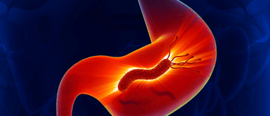 Helicobacter Pylori. El alimento crudo que debes de consumir en ayunas para eliminar la bacteria del Helicobacter Pylori