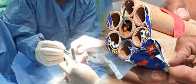 Madre de menor que perdió 1 ojo y 9 dedos al explotar manipular una 'mama rata' en Navidad suplica ayuda Madre de menor que perdió 1 ojo y 9 dedos al explotar manipular una 'mama rata' en Navidad suplica ayuda