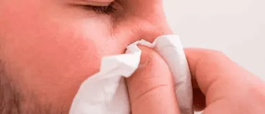 Cómo sonarse la nariz sin dañar tu salud. ¡Evita daños! Los expertos revelan los errores mortales al sonarse la nariz