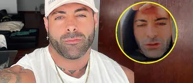 Sebastián Lizarzaburu irreconocible. Sebastián Lizarzaburu se luce con cicatrices y asustó a sus seguidores: “He pasado por días medios complicados”