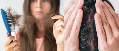 Remedios naturales para lograr que el cabello te crezca más rápido Remedios naturales para acelerar el crecimiento del cabello de forma efectiva