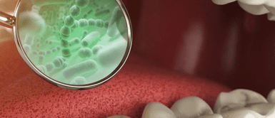 Alimentos que provocan el sarro en los dientes. Estos son los alimentos que provocan sarro en los dientes, según expertos