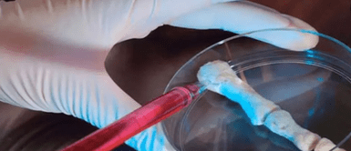 Científicos desarrollan el primer gel que es capaz de regenerar los huesos dañados Científicos crean gel que puede regenerar huesos, pero abre puerta a riesgos desconocidos para la humanidad