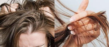 Los mejores champús si tienes las raíces grasas y las puntas secas Los mejores champús si tienes las raíces grasas y las puntas secas