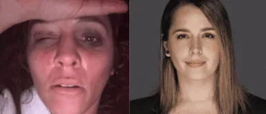 Yiddá Eslava sufre aparatoso accidente Yiddá Eslava sufre fuerte accidente mientras grababa película: “Espero estar mejor”