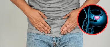 Cáncer de próstata. La vitamina que reduce el riesgo de padecer cáncer de próstata