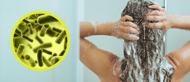 La peligrosa bacteria podría generar graves infecciones. Retiran miles de botellas de shampoo contaminado con bacteria peligrosa