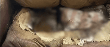 El caso de Lacey Fletcher El caso de Lacey Fletcher: La mujer que 'se deterioró' hasta fundirse en su sofá