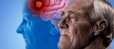 Alzheimer. Descubren el primer recuerdo que pierde una persona en etapa inicial de Alzheimer