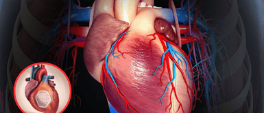 Corazón. Desarrollan un parche de células madre capaz de reparar corazones dañados