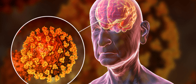 Cerebro afectado. Estudio revela los devastadores efectos de la comida ultraprocesada en tu cerebro