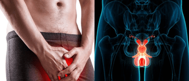 Cáncer de pene. Revelan los síntomas del cáncer de pene que nadie quiere ver, pero no debes ignorar