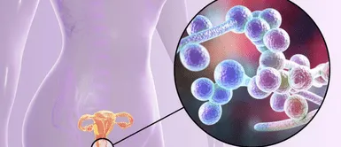 Candidiasis vaginal. El poderoso alimento crudo que elimina la candidiasis vaginal si lo consumes en ayunas